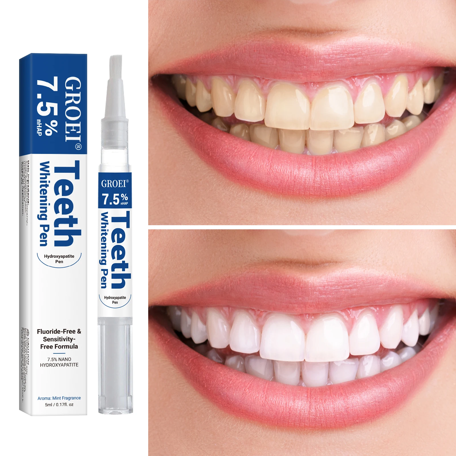 Hydroksiapatytowy długopis do  – Teeth Whitening Near Me recenzja i cena