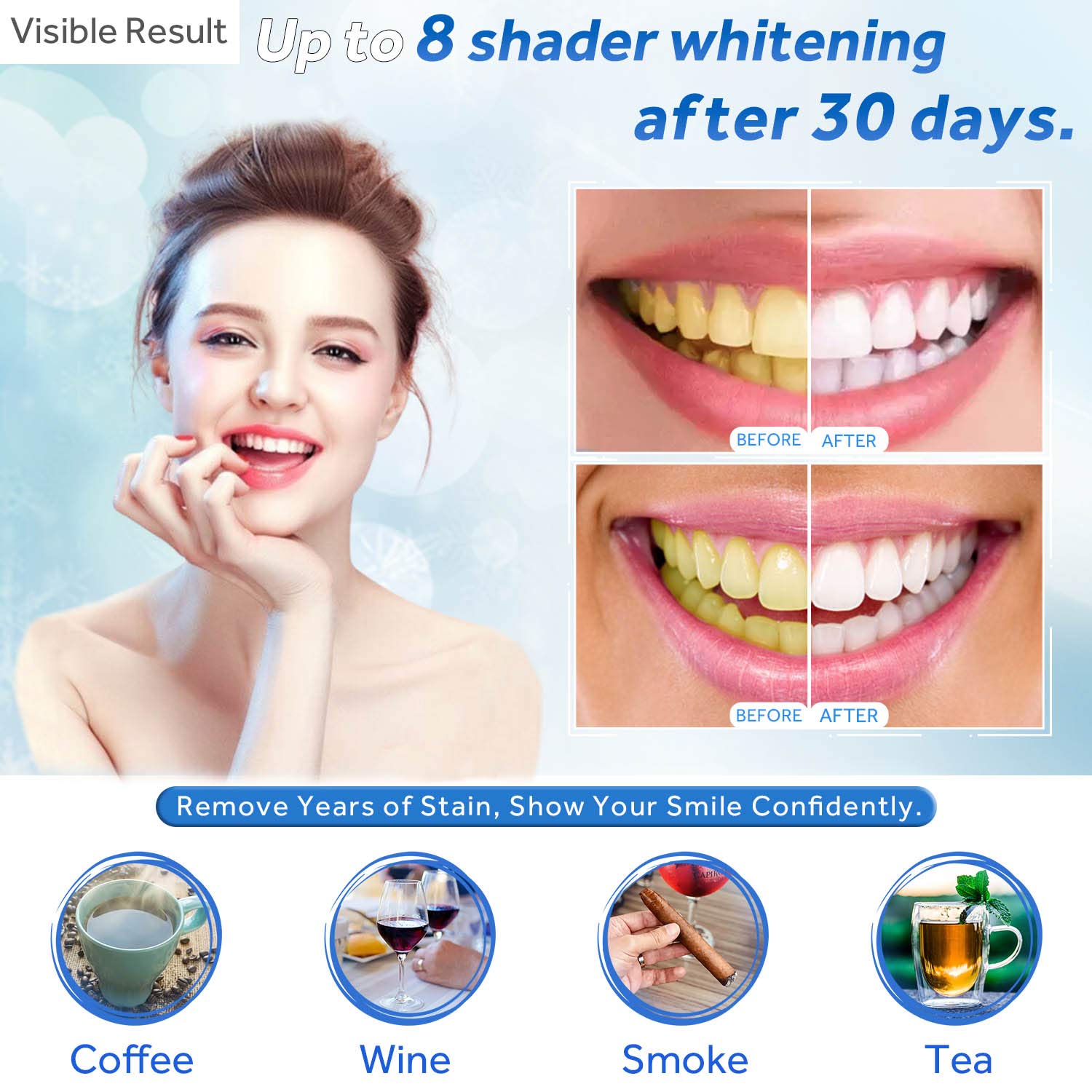 Żel do wybielania zębów w strz – Teeth Whitening Near Me recenzja i cena