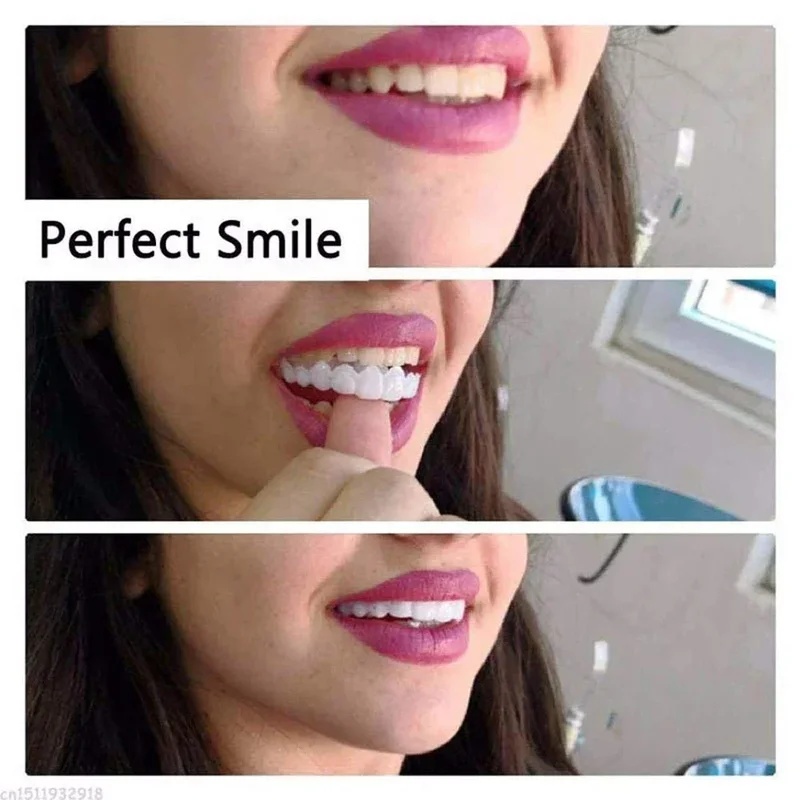 Zestaw zatrzaskowych płyt okła – Teeth Whitening Kit recenzja i cena